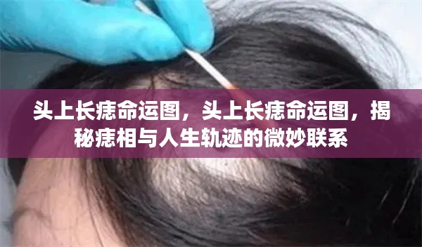 揭秘头上长痣命运图,痣相与人生轨迹的微妙联系探索命运密码