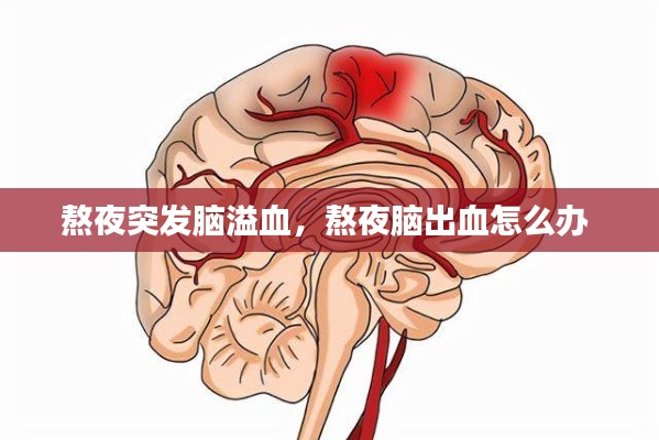 熬夜突发脑溢血,熬夜脑出血怎么办